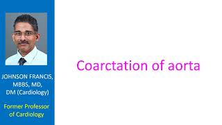 Coarctation of Aorta Clinical SIMPLE UNDERSTANDING  Anatomy  Notching on Ribs [upl. by Arbed128]