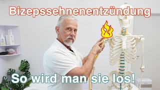 Bizepssehnenentzündung ⚡ So wird man sie los  Übungen und Tipps [upl. by Hildegarde49]