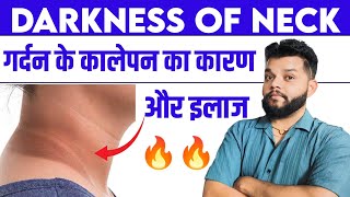 गर्दन और घुटने के कालापन से छुटकारा 🔥 Darkness Of Neck Treatment  Acanthosis Nigricans In Hindi [upl. by Wenda]