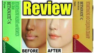 BetnovateC Vs BetnovateN skin care cream review  Betamethasone neomycin  SG Support [upl. by Asirret458]