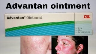 Advantan ointment  Use  Side Effects  Benefits  price review skincare beauty [upl. by Kozloski]