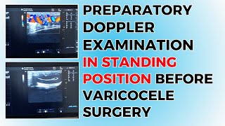 Preparatory Examination Before Varicocele Surgery [upl. by Louisette]