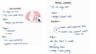 OSTEOCHONDROMA amp OSTEOID OSTEOMA NOTES ONE PAGE NOTES  ORTHOPAEDICS  4TH PROFF  MBBS [upl. by Rosenkranz]