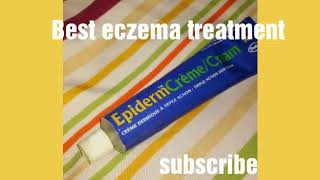 Epiderm cream  How to use Epiderm Cream  uses of Epiderm cream [upl. by Carmon]