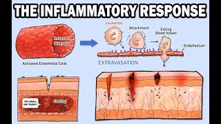 THE INFLAMMATORY RESPONSE [upl. by Sudaorb934]