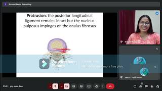 Prolapsed Intervertebral Disc Anatomy of IV Disc Part4 [upl. by Cuttler]