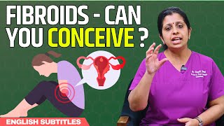 Can you get pregnant with fibroids  ஃபைப்ராய்டு கட்டிகள் இருந்தால் கருத்தரிப்பது பாதிக்கப்படுமா [upl. by Eiznikam]