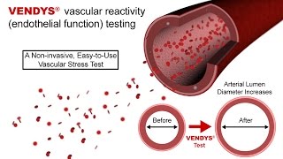 VENDYS  Endothelial Function Measurement Explained [upl. by Venetia]