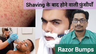 Shaving के बाद होने वाली फुंसीयाँ  Razor Bumps Treatment  Pseudofolliculitis Barbae razorbumps [upl. by Aynatal]