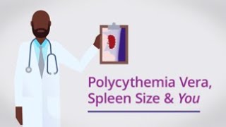 Polycythemia Vera Spleen Size amp You [upl. by Bodwell]