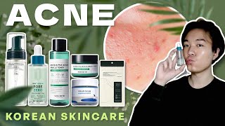 ACNE Treatment  6 Korean Skincare for Oily amp Acne Prone Skin 💦 🇰🇷 [upl. by Rida655]