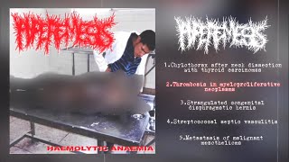 Hyperemesis  Haemolytic Anaemia Split with PxCxSx 2013 Goregrind [upl. by Neelhsa]