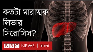 Liver Cirrhosis লিভার সিরোসিস রোগের কারণ লক্ষণ ও চিকিৎসা কী  BBC Bangla [upl. by Royo]