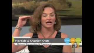 Dr Theresa Ramsey  Fibroids amp Ovarian Cysts [upl. by Albur]