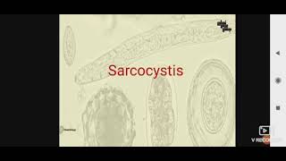 Sarcocystis para L3 [upl. by Draw879]