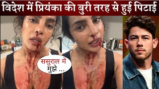 Priyanka Chopra Shocking Video Viral on Social Media Fans Worried after Seeing Her [upl. by Griffith726]