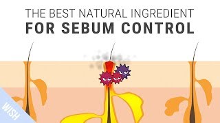 How To Control Excessive Sebum That Leads To Acne  SKINMISO Im A Helper [upl. by Jason]