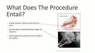 Retrograde Urethrogram amp voiding Cystourethrogram [upl. by Africa]