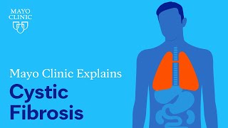 Mayo Clinic Explains Cystic Fibrosis [upl. by Nnaeus778]