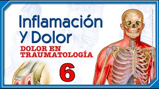 Inflamación y Dolor  Dolor en Traumatología [upl. by Ennairek]