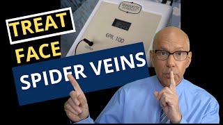 Learn How To Remove Spider Veins on the Cheeks Chin and Nose A Guide for Doctors and Nurses [upl. by Jandel]