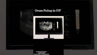 The Incredible Science Behind IVF Egg Retrieval [upl. by Odraboel]