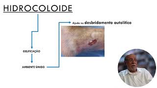 HIDROCOLOIDE Parte 2 [upl. by Ardnohs]