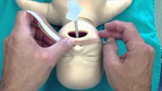 Taping a Neonatal ETT [upl. by Ahola508]