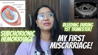 HEAVY SUBCHORIONIC BLEEDING DURING PREGNANCY🥺 My Miscarriage in 1st Trimester l Painful Abortion ☹️ [upl. by Trip]