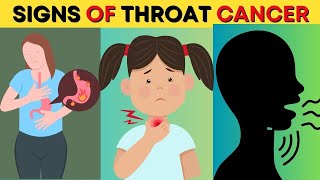 Throat Cancer Signs 8 Warning Signs of Throat Cancer You Should NEVER Ignore [upl. by Kahl]