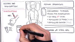 Diabetic Ketoacidosis Diabetes Type I Management Summary [upl. by Hcirdla]