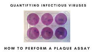 How to Perform a Plaque Assay [upl. by Basso166]