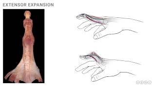 Anatomy of the Upper Limb Extensor Expansion [upl. by Svetlana751]