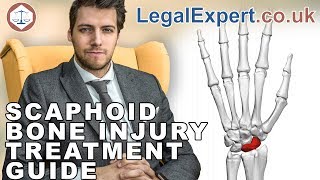 Scaphoid Bone Injury Treatment Guide  2021  UK [upl. by Ciredec]