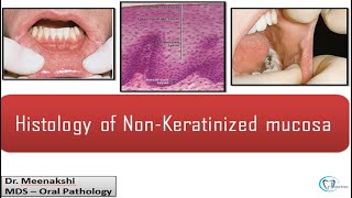 Histology Of Non Keratinised Mucosa [upl. by Adnarem266]