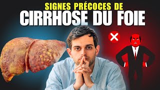 9 signes précoces de CIRRHOSE DU FOIE Ce Que Vous Devez Vraiment Savoir [upl. by Abott]