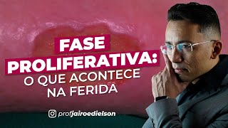 Fase proliferativa o que acontece na ferida [upl. by Asehr]