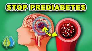 TOP 11 Prediabetes Symptoms and Treatment  How to STOP Prediabetes NOW [upl. by Beatrisa]