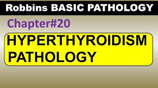 Ch20  Hyperthyroidism Pathology  Robbins Pathology  Dr Asif Lectures [upl. by Aryahay]