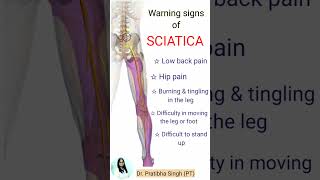 Warning signs of Sciatica  Pain down to leg  Radiating pain sciatica shorts [upl. by Ived]