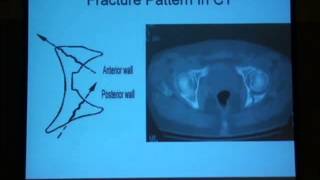 12 Radiological diagnosis of the acetabulum H Abdel Azeem [upl. by Amej]