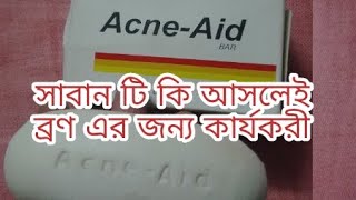 Acne aid soap bar review [upl. by Pauly327]