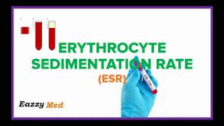 Erythrocyte Sedimentation Rate ESR Made Simple [upl. by Chadabe712]