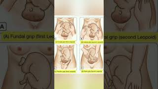 Baby position  different grip while labor stages 🤰knowledge easylearning shortsvideo share [upl. by Feledy]