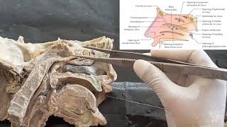 Dissection of lateral wall of nasal cavity  Anatomy of meatus and concha  structures within meatus [upl. by Ardnac442]