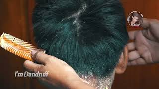 Dandruff Removal Long Hair Guys 83 [upl. by Ellga]