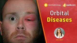 Orbital Diseases  Medical School  Ophthalmology Education Videos Lecture  VLearning [upl. by Lavona486]