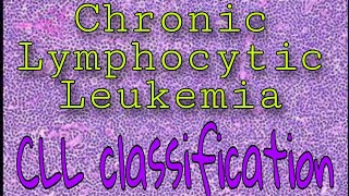 Chronic Lymphocytic Leukemia [upl. by Gare958]