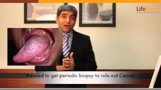 Treatment for Oral Lichen Planus Explained by Dr Rajesh Shah MD [upl. by Bobine308]