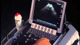 How To Transabdominal View of the Female Pelvis with Ultrasound [upl. by Elton]